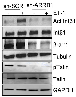 Representative WB of whole cell lysates from sh-SCR and sh-ARRB1 HOFs stimulated or not with ET-1 (5 min) and probed with antibodies to active or total Intβ1, b-arr1, pTalin (cat. TP4171) and Talin. Image from publication CC-BY-4.0. PMID: 38777849
