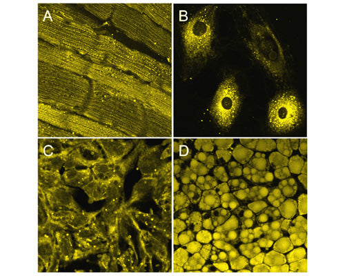 Staining of lipids with TR-600-P1 in muscle tissue (A), cardiomyocytes (B), vesicular structures (C) and fenal adipose tissue (D).