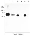Immunocytochemical labeling of Trop-2 in paraformaldehyde fixed human A431 cells. The cells were labeled with mouse monoclonal anti-Trop-2 (clone M005). The antibody was detected using goat anti-mouse DyLight® 594.