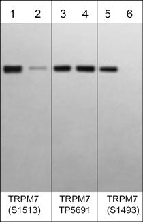 Western blot image of human autophosphorylated TRPM7 C-terminal kinase domain (lanes 1-6). The blot was treated with lambda phosphatase to dephosphorylate TRPM7 phosphosites (lanes 2, 4, & 6). The blot was probed with rabbit polyclonals anti-TRPM7 (Ser-1513) phospho-specific (lanes 1 & 2), anti-TRPM7 (a.a.1484-1497) TP5691 antibody (lanes 3 & 4), or anti-TRPM7 (Ser-1493) phospho-specific (lanes 5 & 6).