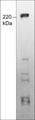 Western blot image of TRPM7 expression in human MCF-7 cell lysate. The blot was probed with mouse monoclonal anti-TRPM7 (Extracellular region) M573 at a dilution of 1:250.