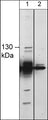 Western blot image of human TRPM8 in human MDA-MB-231 cells. The blot was probed with rabbit polyclonal anti-TRPM8 (extracellular region) without peptide blocking (lane 1) or with peptide blocking (lane 2).