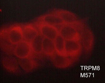 Immunocytochemical labeling of TRPM8 in paraformaldehyde fixed and NP-40 permeabilized MCF-7 cells. The cells were labeled with mouse monoclonal anti-TRPM8 (M571). The antibody was detected using goat anti-mouse DyLight® 594.
