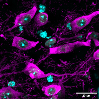 Immunostaining of paraformaldehyde-fixed (4%) free-floating sections (50 µm) of the posterior area of the brain (ventral tegmental area/substania nigra) of an adult mouse brain containing TH+ neurons. TH antibody (cat. TYH-0020) dilution @ 1:1500 with secondary detection of the chicken antibody with Alexa-647 anti-chicken IgY, 1:1000. (Image courtesy of Antonella Rios, Duke University.)