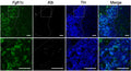 In situ hybridization of Fgfr1c mRNA (green) and Klb mRNA (white), immunostaining for tyrosine hydroxylase (TH; cat. TYH, 1:1000; blue), and the merge of the three. Two different magnifications are shown, with the boxed area in the top