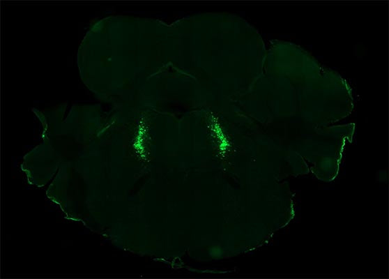 Immunostaining of noradrenergic neurons in the locus coeruleus of a C57BL/6J mouse labeling tyrosine hydroxylase (Aves cat no TYH, 1:1000, green). Image kindly provided by Dr. Mihwa Choi, UT Southwestern Medical Center.