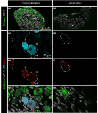 Fluorescent Immunohistochemistry and RNAscope in situ hybridization was performed on samples from Phox2b‐Cre‐ZsGreen mice to visualize the presence if TH (cat. TYH, 1:2000) and Agtar1 mRNA respectively. (a, c, e, g) Immunoreactivity for TH and Agtar1 mRNA expression varied between neurons in the NG (profiles are dotted outlines 1 – 4). (b, d, f, h) Neither marker was detected in extraganglionic neurons in the vagus nerve (dotted outline). CC-BY-4.0. PMID:37403978