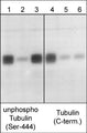 Western blot analysis of mouse brain. The blot was probed with anti-unphosphorylated βIII-Tubulin (Ser-444) (lanes 1-3) and anti-βIII-Tubulin (C-terminus) (lanes 4-6) polyclonal antibodies. Both antibodies were used in the presence of unphosphorylated βIII-Tublin (Ser-444) peptide (lanes 2 & 5; TX1815) and phospho-βIII-Tublin (Ser-444) peptide (lanes 3 & 6; TX1695).