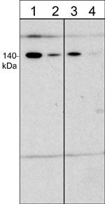 Immunocytochemical labeling of VE-Cadherin in paraformaldehyde-fixed and NP-40-permeabilized human umbilical vein endothelial cells. The cells were labeled with rabbit polyclonal VE-Cadherin (a.a. 770-781), then the antibody was detected using appropriate secondary antibody conjugated to Cy3. Phase image (left) and fluorescent image (right).
