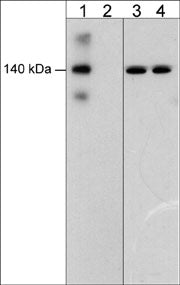 Western blot image of human umbilical vein endothelial cells stimulated with pervanadate (1 mM) for 30 min. then the blots were untreated (lanes 1 & 3) or treated with alkaline phosphatase (lanes 2 & 4). The blots were probed with rabbit polyclonal anti-VE-cadherin (Tyr-685) (lanes 1 & 2) or mouse monoclonal anti-VE-cadherin (lanes 3 & 4).