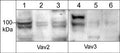 Western blot of human Jurkat (lanes 1 & 4), HUVEC (lanes 2 & 5), and A431 (lanes 3 & 6) cells. The blots were probed with anti-Vav2 (a.a. 309-322) at a dilution of 1:500 (lanes 1-3) and anti-Vav3 (a.a. 293-305) at 1:500 (lanes 4-6).