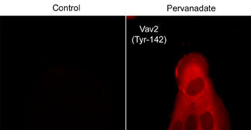 Immunocytochemical labeling of VAV2 in control and pervanadate-treated human A431 cells. The cells were fixed in paraformaldehyde and permeabilized using NP-40. Then labeled with rabbit polyclonal Vav2 (Tyr-142). The antibody was detected using goat anti-rabbit DyLight® 594.