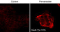 Immunocytochemical labeling of VAV2 in control and pervanadate-treated human A431 cells. The cells were fixed in paraformaldehyde and permeabilized using NP-40. Then labeled with rabbit polyclonal Vav2 (Tyr-172). The antibody was detected using goat anti-rabbit DyLight® 594.