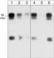 Western blot of human SYF cSrc-transformed cells. Blots were were probed with anti-WAVE1 (N-terminal region) at a dilution of 1:1000 (lane 1), 1:2000 (lane 2) or 1:4000 (lane 3). In addition, the antibody was used in the absence (lane 4) or presence of blocking peptides, WAVE1 (N-terminal region) peptide (lane 5) or WAVE2 (Central region) peptide (lane 6).