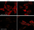 Immunocytochemical labeling of phosphorylated WAVE in pervanadate-treated mouse C2C12. The cells were labeled with rabbit polyclonal WAVE1 (N-terminal region) and WAVE (Tyr-125) antibodies, then the antibodies were detected using appropriate secondary antibodies conjugated to Cy3.
