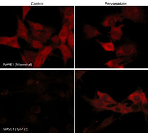 Immunocytochemical labeling of phosphorylated WAVE in pervanadate-treated mouse C2C12. The cells were labeled with rabbit polyclonal WAVE1 (N-terminal region) and WAVE (Tyr-125) antibodies, then the antibodies were detected using appropriate secondary antibodies conjugated to Cy3.