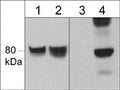 Western blot of human SYF cSrc transformed cells untreated (lanes 1 & 3) or treated (lanes 2 & 4) with pervanadate (1 mM; 30 min). The blots were probed with anti-WAVE1 (N-terminal region) (lanes 1 & 2) or anti-WAVE (Tyr-125) (lanes 3 & 4).