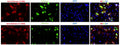 Immunofluorescent staining of ZsGreen-transfected COS-7 cells using Aves Labs chicken polyclonal anti-ZsGreen antibody (red, Cat No. ZSGREEN-0100) and showing ZsGreen autofluorescence (green). The cells were fixed with 3% paraformaldehyde, washed with PBS, and blocked/permeabilized with 5% non-fat milk powder in PBST. The anti-ZsGreen chicken polyclonal antibody (Cat No. ZSGREEN-0100) was incubated with the sample at a dilution of 1:500 (0.4μg/mL) or 1:1000 (0.2 μg/mL) at 4C overnight. After washing with PBST, the cells were stained using goat anti-chicken IgY CF594 secondary antibody (Cat No. 80-1001-594) (red). The staining revealed a complete overlap between the signal from the chicken anti-ZsGreen antibody and the ZsGreen autofluorescence in transfected cells. The cells were mounted with Antibodies Incorporated Fluoroshield with DAPI mounting medium (Cat No. AR-6501). DAPI nuclear stain (blue) shows cell nuclei.