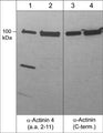 Western blot analysis of α-actinin in human A431 cells (lanes 1 & 3) and rabbit spleen fibroblasts (lanes 2 & 4). The blots were probed with rabbit polyclonal anti-α-actinin 4 (a.a. 2-11) or mouse monoclonal anti-α-actinin (C-terminal region).