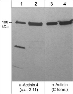 Western blot analysis of α-actinin in human A431 cells (lanes 1 & 3) and rabbit spleen fibroblasts (lanes 2 & 4). The blots were probed with rabbit polyclonal anti-α-actinin 4 (a.a. 2-11) or mouse monoclonal anti-α-actinin (C-terminal region).