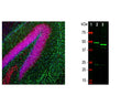 Left: Analysis of GFAP expression (green) in mouse hippocampus section by Immunohistochemistry. Section was stained with chicken anti-GFAP antibody (1:5,000) and co-stained with rabbit antibody to FOX3/NeuN (R-3770-100, 1:5,000, red). Blue: DAPI nuclear stain. IHC Method: Following transcardial perfusion with 4% PFA, mouse brain was post fixed for 24 hours, cut into 45 uM sections, and free-floating sections were stained. The GFAP antibody stains a network of astroglial cells, while the Fox3/NeuN antibody stains the nuclei and proximal perikarya of neurons. Right: Western blot analysis of GFAP expression in whole rat (2) and mouse (3) brain lysates using chicken anti-GFAP antibody (1:5,000). The strong band at about 50 kDa corresponds to GFAP protein. Smaller proteolytic fragments and alternate transcripts of GFAP may also be detected on such blots.