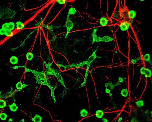 Mixed neuron glia cultures stain with Chicken polyclonal antibody to Internexin alpha C-1377-50 (red) and counterstained with Rabbit polyclonal antibody to Coronin 1a: Whole serum, R-1335-50 (green) which is an excellent marker of microglia and lymphocytes. This internexin antibody is an excellent marker of neuronal processes in these cultures.