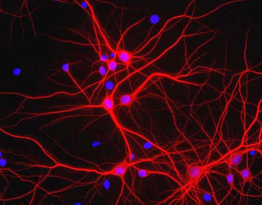 View of mixed neuron/glial cultures stained with Chicken polyclonal antibody to Microtubule Associated Protein 2 C-1382-50 (red). The perikarya and dendrites of neurons are strongly and specifically stained with this antibody while the axons of the neurons and the processes of all other cell types in these cultures (astrocytes, oligodendrocytes, microglia, endothelia and fibroblasts) are all negative. Cell nuclei are visualized with DAPI DNA stain.