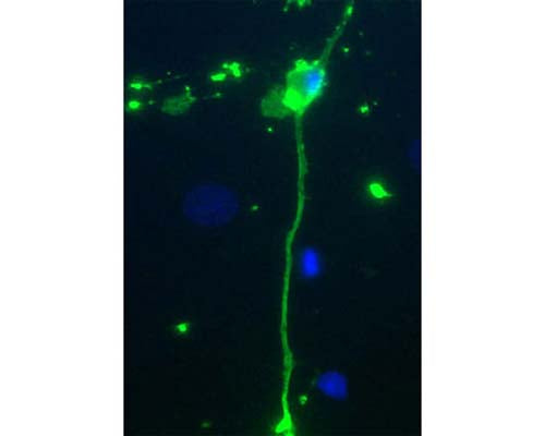 Image shows rat mixed neuron/glial cultures stained with Chicken polyclonal antibody to Myelin Basic Protein antibody C-1383-50 (green). Blue is a DNA stain. Note that the antibody stains an oligodendrocyte and some membrane shed from this cell. Other cells in the field include neurons, astrocytes, microglia and fibroblasts, all of which are completely negative.