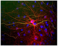 Image of mixed neuron and glial cultures stained by Immunofluorescence and Immunocytochemistry. The cultures were stained with C-1390-50, Neurofilament light polypeptide (NF-L), Chicken pAb (red), and co-stained with product R-1388-50, Neurofilament heavy polypeptide phosphorylated (pNF-H), Rabbit pAb, (green). The Neurofilament Light (NF-L) protein is assembled into neurofilaments which are found throughout the axons, dendrites and perikarya of these cells. In contrast, the phosphorylated Neurofilament Heavy (NF-H) has a much more restricted expression pattern, being found only in developed axonal neurofilaments. Since both proteins are found in neurofilaments, the red and green patterns overlap, so that neurofilaments containing NF-L and phosphorylated NF-H appear yellowish. In contrast neurofilaments containing only NF-L appear red.