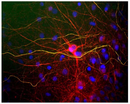 Image of mixed neuron and glial cultures stained by Immunofluorescence and Immunocytochemistry. The cultures were stained with C-1390-50, Neurofilament light polypeptide (NF-L), Chicken pAb (red), and co-stained with product R-1388-50, Neurofilament heavy polypeptide phosphorylated (pNF-H), Rabbit pAb, (green). The Neurofilament Light (NF-L) protein is assembled into neurofilaments which are found throughout the axons, dendrites and perikarya of these cells. In contrast, the phosphorylated Neurofilament Heavy (NF-H) has a much more restricted expression pattern, being found only in developed axonal neurofilaments. Since both proteins are found in neurofilaments, the red and green patterns overlap, so that neurofilaments containing NF-L and phosphorylated NF-H appear yellowish. In contrast neurofilaments containing only NF-L appear red.
