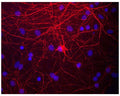 Image of mixed neuron and glial cultures stained by Immunofluorescence and Immunocytochemistry. These cultures were stained with C-1393-50, Neurofilament medium polypeptide (NF-M), Chicken pAb, (red). The Neurofilament Medium (NF-M) protein is assembled into neurofilaments which are found throughout the axons, dendrites and perikarya of these cells.