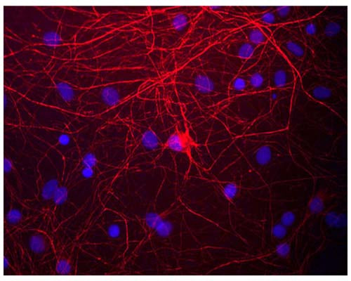 Image of mixed neuron and glial cultures stained by Immunofluorescence and Immunocytochemistry. These cultures were stained with C-1393-50, Neurofilament medium polypeptide (NF-M), Chicken pAb, (red). The Neurofilament Medium (NF-M) protein is assembled into neurofilaments which are found throughout the axons, dendrites and perikarya of these cells.