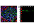 Left: Analysis of peripherin expression in mixed fibroblast and PC12 pheochromocytoma cell culture by Immunocytochemistry. Cells were stained with chicken antibody to peripherin (1:5,000, green), and co-stained with rabbit antibody to vimentin (R-1699-100, 1:2,000, red). Blue: DAPI nuclear stain. The peripherin antibody reveals cytoplasmic filamentous staining in the small PC12 cells, while the vimentin antibody stains intermediate filaments in the surrounding fibroblastic cells which do not express peripherin. Right: Western blot analysis of spinal cord tissue lysates (lanes 2-5) and cell lysates (lanes 6 and 7) with chicken antibody to peripherin (1:10,000). [1] protein standard, [2] rat, [3] mouse, [4] pig, [5] cow, [6] SH-SY5Y, [7] PC12. The band at 57 kDa corresponds to peripherin protein.