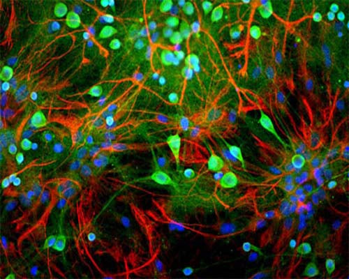 Image shows rat mixed neuron/glial cultures stained with Chicken polyclonal antibody to Ubiquitin C Terminal Hydrolase 1 C-1406-50 (green) and Rabbit polyclonal antibody to Glial Fibrillary Acidic Protein R-1374-50 (red). Blue is a DNA stain. Note that the Ubiquitin antibody stains neurons strongly and specifically and that the staining is concentrated in the cell bodies, though some does extend into the dendrites also.