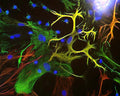 View of mixed neuron/glial cultures stained with Chicken polyclonal antibody to Vimentin C-1409-50 (green) and Rabbit polyclonal antibody to Glial Fibrillary Acidic Protein R-1374-50 (red). Vimentin is expressed alone in fibroblastic and endothelial cells, which are the flattened cells in the middle of the imate which appear green. Astrocytes may express primarily Glial Fibrillary Acidic Protein (GFAP), or GFAP and vimentin, and so appear red (GFAP only) or golden yellow (GFAP and Vimentin). In cells which express both GFAP and vimentin, the two protein assemble to produce heteropolymer filaments.