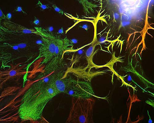 View of mixed neuron/glial cultures stained with Chicken polyclonal antibody to Vimentin C-1409-50 (green) and Rabbit polyclonal antibody to Glial Fibrillary Acidic Protein R-1374-50 (red). Vimentin is expressed alone in fibroblastic and endothelial cells, which are the flattened cells in the middle of the imate which appear green. Astrocytes may express primarily Glial Fibrillary Acidic Protein (GFAP), or GFAP and vimentin, and so appear red (GFAP only) or golden yellow (GFAP and Vimentin). In cells which express both GFAP and vimentin, the two protein assemble to produce heteropolymer filaments.