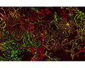 A view of neonatal rat brain cultures stained with Chicken polyclonal antibody to Vimentin C-1409-50 (red) and with Rabbit polyclonal antibody to GFAP R-1374-50 (green). These two proteins are found only in non-neuronal cells so you can\'t see any neurons, except for their nuclei in blue. Maturish astrocytes have only GFAP so appear green or have a mix of both proteins, so appear yellow. Some cells only have the vimentin (immature astrocytes, microglia and fibroblasts) and so appear red.
