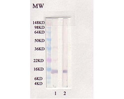 Anti-Leptin Antibody