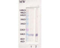 Anti-Leptin Antibody