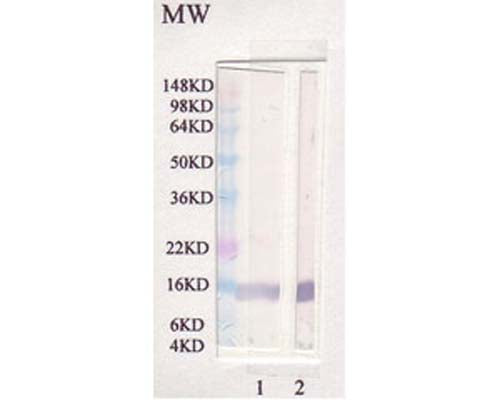 Anti-Leptin Antibody