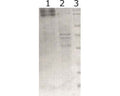 Western-Blot detection of human RET expressed in CHO cells. Line 1. hRET-containing CHOEBNALT85 cell culture supernatant. Line 2. Negative control - CHOEBNALT85 cell culture supernatant. 5 uL of supernatant were loaded per line. Primary antibody dilution 1:5000 was used. Rabbit polyclonal to chicken IgY was used as secondary antibody.
