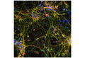 Immunofluorescence analysis of tau protein expression in cortical neuron-glial culture from E20 rat. The chicken anti-tau antibody (green, 1:2,000) stains perikarya, dendrites and axons of neurons, while a anti-MAP2 antibody labels only dendrites and perikarya (red). Perikarya and dendrites appear orange-yellow, since they contain both MAP2 and tau proteins. Blue: DAPI nuclear stain.