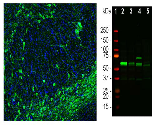 Left: Visualization of tyrosine hydroxylase expression in rat brain by Immunofluorescent analysis. Section was stained with chicken anti-TH antibody, C-2126-100, (green, 1:5,000) and Hoechst staining of nuclear DNA (blue). Product C-2126-100 stains the dopaminegic TH-positive neurons and their processes of the substantia nigra. Right:  Western blot analysis of tissues and lysates using C-2126-100 (green, 1:50,000) with a band at approx. 58kDa in brain tissue lysates. Lane 1: protein standard (red); Lane 2: rat brain caudate/putmen region; Lane 3: rat brain midbrain; Lane 4: whole mouse midbrain; Lane 5: cow midbrain segment.