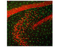 Image of a rat hippocampus section by Immunofluorescence and Immunohistochemistry. The section was stained with C-2127-100, Neuronal nuclei antigen [NeuN] /RNA binding protein fox-1 homolog 3 [FOX3], (NeuN/FOX3), Chicken pAb, (red, 1:5,000),, and co-stained with productR-1820-50, Ionized calcium-binding adapter molecule 1 (IBA1), Rabbit pAb, (1:2,000, green). Product C-2127-100 stains the nuclei and distal perikarya of most neurons, while product R-1820-50 labels microglial cells. IHC Method: Following transcardial perfusion with 4% paraformaldehyde, rat brain was post fixed for 24 hours, cut to 35µm, and free floating sections were stained.