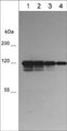 Western blot image of human A431 cells (lanes 1-4). The blots were probed with mouse monoclonals anti-P-Cadherin at 1:250 (lane 1) and 1:500 (lane 2), 1:1000 (lane 3) and 1:2000 (lane 4).