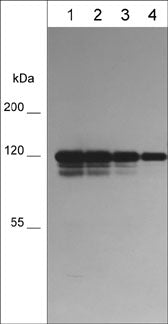 Western blot image of human A431 cells  (lanes 1-4). The blots were probed with mouse monoclonals anti-P-Cadherin at 1:250 (lane 1) and 1:500 (lane 2), 1:1000 (lane 3) and 1:2000 (lane 4).