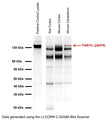 Western blot analysis of TrkB pS478 expression in rodent brain homogenates (40 μg/lane) with R-1718-50, using CL-2107-50 as positive control lysate (10 μg/lane). SDS-PAGE: 4-12%, reducing conditions; Transfer: Towbin’s Tris-Glycine buffer, PVDF membrane (0.45 μm); Blocking buffer and antibody diluent: Mixture of 2.5% skim milk and 2.5% BSA in TBST, blocking 1 hour at RT; Primary antibody: 1 μg/mL, overnight at 2-8°C; Secondary antibody: anti-rabbit-HRP (1/10,000) 2.5 hours at RT; Detection: Chemiluminiscence. Tissue samples show expression of TrkB phosphorylated at serine residue 478 with a molecular weight of ~120 kDa. The retinoic acid (1 μM)- and BDNF-treated (50 ng/mL, 15 min) cell lysate (10 μg loading) serves as positive control supporting the assignment of the phosphorylated TrkB band. Additional bands are observed in tissue samples that have not yet been characterized.