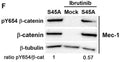 An analysis of the phosphorylation of β-catenin at Y654 in Mec-1 cells transfected with the S45A mutant or an empty plasmid (mock). Where indicated, the cells were pretreated or not with ibrutinib (100 nM) for 1 h. The Western blot is representative of 3 independent experiments. Image from publication CC-BY-4.0. PMID: 38139452