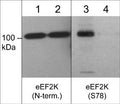 Western blot image of C2C12 treated with calyculin A (100 nM) for 30 min. (lanes 1 & 3), then the blot was treated with lambda phosphatase (lanes 2 & 4). The blot was probed with anti-eEF2K (N-terminus) at 1:500 (lanes 1 & 2) and anti-eEF2K (Ser-78) (EP4391) at 1:1000.