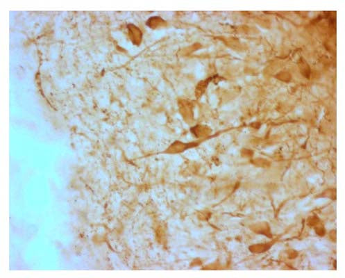 The 4% PFA fixed, frozen cryostat section of the sheep hypothalamus was incubated in guinea pig polyclonal antibodies to the mouse AGRP protein at the dilution of 1:1000 overnight followed by incubation with biotinylated secondary antibodies. Cell bodies and nerve terminals in the sheep brain are intensely stained. This figure shows staining of cells when no pre-absorption is performed.